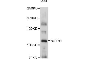 Western blot analysis of extracts of 293T cells, using NLRP11 antibody (ABIN6131484, ABIN6144660, ABIN6144661 and ABIN6215714) at 1:1000 dilution. (NLRP11 anticorps  (AA 420-600))