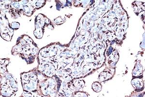 Immunohistochemistry of paraffin-embedded human placenta using PDCD4 Rabbit mAb  at dilution of 1:100 (40x lens).