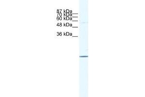 WB Suggested Anti-E2F6 Antibody   Titration: 1. (E2F6 anticorps  (Middle Region))