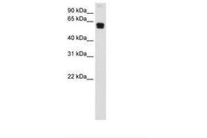 Image no. 1 for anti-Docking Protein 1, 62kDa (Downstream of tyrosine Kinase 1) (DOK1) (C-Term) antibody (ABIN6736686)