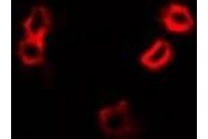 Immunofluorescent analysis of HAX1 staining in A549 cells.