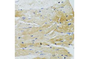 Immunohistochemistry of paraffin-embedded rat heart using MOAP1 antibody (ABIN6290585) at dilution of 1:100 (40x lens).