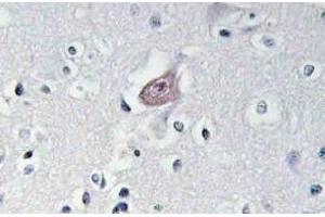 Immunohistochemistry analysis of p-Abl1/2 antibody (pTyr393/439) Cat.