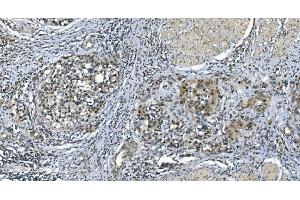IHC analysis of LSM7 using anti-LSM7 antibody (ABIN7598937). (LSM7 anticorps  (AA 1-103))