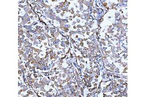 IHC analysis of Hsp47/SERPINH1 using anti-Hsp47/SERPINH1 antibody (ABIN3043331). (SERPINH1 anticorps  (AA 247-418))