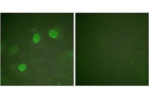 Immunofluorescence analysis of HeLa cells, using GATA3 antibody. (GATA3 anticorps)