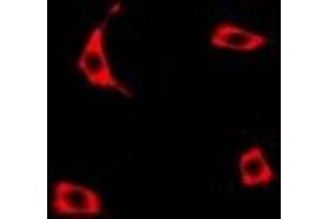 Immunofluorescent analysis of Transcobalamin-1 staining in U2OS cells.