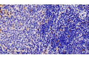 Detection of IBA1 in Rat Spleen Tissue using Polyclonal Antibody to Ionized Calcium-binding Adapter Molecule 1 (IBA1)