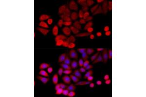 Immunofluorescence analysis of HeLa cells using PIDD antibody (ABIN1680710, ABIN3019230, ABIN3019231, ABIN5664897 and ABIN6220775) at dilution of 1:100 (40x lens). (PIDD anticorps  (AA 1-85))