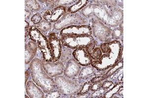 Immunohistochemical staining of human kidney with IL20RA polyclonal antibody  shows strong cytoplasmic positivity in renal tubules at 1:200-1:500 dilution.