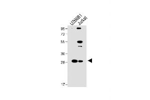 All lanes : Anti-LTM5 Antibody (N-term) at 1:1000 dilution Lane 1: U266B1 whole cell lysate Lane 2: Jurkat whole cell lysate Lysates/proteins at 20 μg per lane.