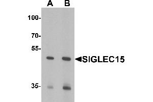 Western blot analysis of SIGLEC15 in Rat kidney tissue lysate with SIGLEC15 antibody at (A) 1 and (B) 2 µg/mL (SIGLEC15 anticorps  (N-Term))