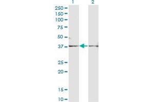 Western Blot analysis of FST expression in transfected 293T cell line by FST monoclonal antibody (M01A), clone 1G4.