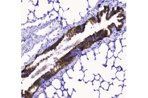 IHC analysis of COX IV using anti-COX IV antibody .