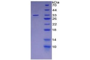 SDS-PAGE of Protein Standard from the Kit (Highly purified E.