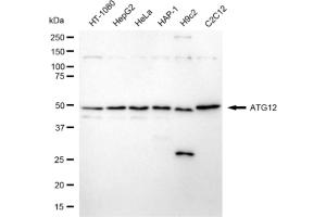 Western blotting analysis using ATG12 antibody (ABIN7797707).