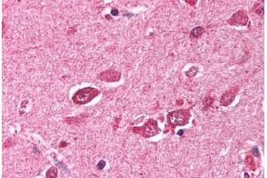 anti-Tripartite Motif Containing 38 (TRIM38) (C-Term) antibody