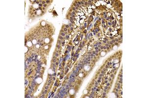 Immunohistochemistry of paraffin-embedded mouse ileum using CLASP1 antibody (ABIN5974258) at dilution of 1/100 (40x lens). (CLASP1 anticorps)