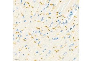 Immunohistochemistry of paraffin embedded mouse heart using THNSL2 (ABIN7075893) at dilution of 1: 400 (400x lens)