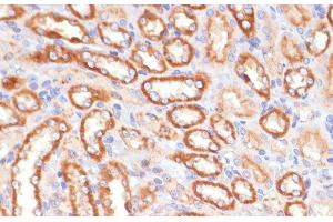 Immunohistochemistry of paraffin-embedded Rat kidney using CYB5A Polyclonal Antibody at dilution of 1:100 (40x lens). (CYB5A anticorps)