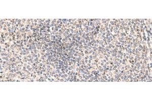 Immunohistochemistry of paraffin-embedded Human tonsil tissue using MLKL Polyclonal Antibody at dilution of 1:85(x200) (MLKL anticorps)