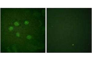 Immunofluorescence analysis of HuvEc cells, using AOS1 Antibody. (SAE1 anticorps  (AA 221-270))
