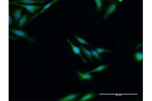 Immunofluorescence of purified MaxPab antibody to ELP3 on HeLa cell.