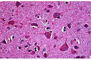 Human Brain, Cortex: Formalin-Fixed, Paraffin-Embedded (FFPE)