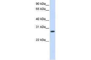 HSD11B1 antibody used at 1 ug/ml to detect target protein.