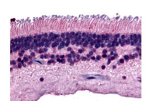 Anti-PTPRM antibody IHC of human eye, retina.