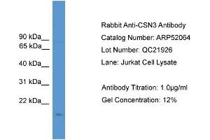 WB Suggested Anti-CSN3  Antibody Titration: 0. (CSN3 anticorps  (N-Term))