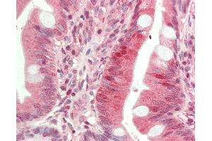 Anti-HDAC9 antibody IHC staining of human small intestine. (HDAC9 anticorps  (Internal Region))