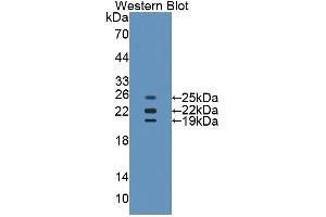 WB of Protein Standard: different control antibodies  against Highly purified E. (Catalase Kit ELISA)