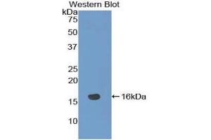 Detection of Recombinant NRARP, Mouse using Polyclonal Antibody to Notch Regulated Ankyrin Repeat Protein (NRARP) (NRARP anticorps  (AA 3-109))