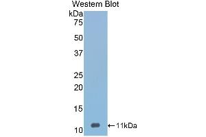 Western Blotting (WB) image for anti-serpin Peptidase Inhibitor, Clade A (Alpha-1 Antiproteinase, Antitrypsin), Member 12 (SERPINA12) (AA 71-148) antibody (ABIN1173453) (SERPINA12 anticorps  (AA 71-148))