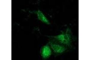 Anti-ACAT2 mouse monoclonal antibody (ABIN2453825) immunofluorescent staining of COS7 cells transiently transfected by pCMV6-ENTRY ACAT2 (RC201821). (ACAT2 anticorps)