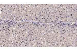 Detection of RELN in Human Liver Tissue using Monoclonal Antibody to Reelin (RELN)