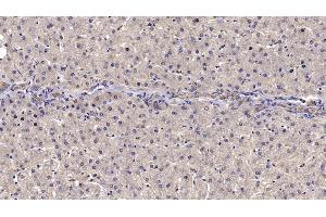 Detection of RELN in Human Liver Tissue using Monoclonal Antibody to Reelin (RELN) (Reelin anticorps  (AA 26-190))