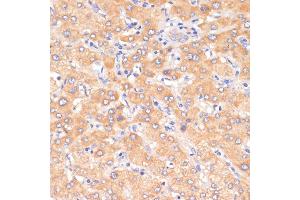 Immunohistochemistry of paraffin-embedded human liver using PDCD2L antibody (ABIN6130653, ABIN6145336, ABIN6145337 and ABIN6223261) at dilution of 1:100 (40x lens). (PDCD2L anticorps  (AA 1-358))