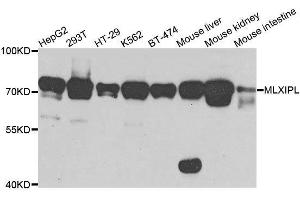 Western blot analysis of extracts of various cell lines, using MLXIPL antibody. (MLXIPL anticorps  (AA 17-175))