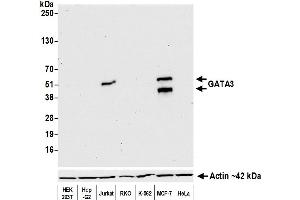 Western Blotting (WB) image for anti-GATA Binding Protein 3 (GATA3) (AA 150-200) antibody (ABIN7455153)