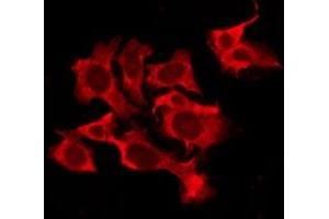 ABIN6276209 staining Hela by IF/ICC. (QRFPR anticorps  (Internal Region))