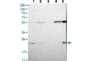 Western blot analysis of Lane 1: RT-4, Lane 2: U-251 MG, Lane 3: Human Plasma, Lane 4: Liver, Lane 5: Tonsil with FAM213B polyclonal antibody . (C1orf93 anticorps)