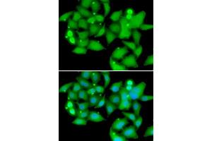 Immunofluorescence analysis of A549 cells using UBASH3B antibody (ABIN5974296).