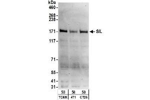 Western Blotting (WB) image for anti-SCL/TAL1 Interrupting Locus (STIL) (AA 1237-1287) antibody (ABIN7452042)