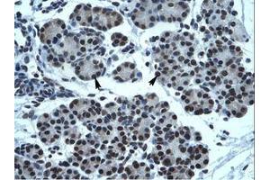 anti-Transmembrane Phosphatase with Tensin Homology (TPTE) (AA 461-510) antibody