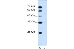 WB Suggested Anti-C19orf28 Antibody Titration:  0. (C19orf28 anticorps  (Middle Region))