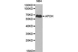 Western blot analysis of NB4 cell lysate using APOH antibody.