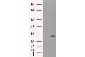 Western Blotting (WB) image for anti-Nitrilase 1 (NIT1) antibody (ABIN1499735) (Nitrilase 1 anticorps)
