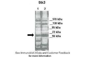 Lanes:   Lane 1: 30ug of HeLa cell lysate Lane 2: 30ug of 293T cell lysate  Primary Antibody Dilution:   1:2000  Secondary Antibody:   Anti-rabbit-HRP  Secondary Antibody Dilution:   1:5000  Gene Name:   STK3  Submitted by:   Jixin Dong & Yuanhong Chen,University of Nebraska